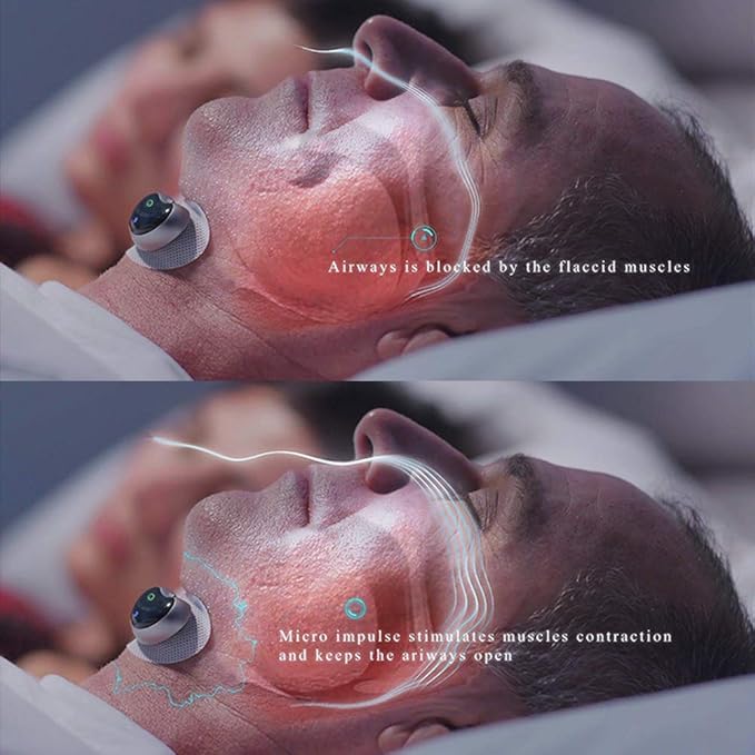 Smart Anti-Snoring Device Electronic Muscle Stimulator
