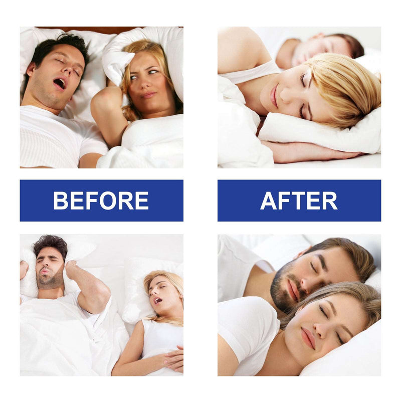 Anti-Snoring Nursing Sleep Patch