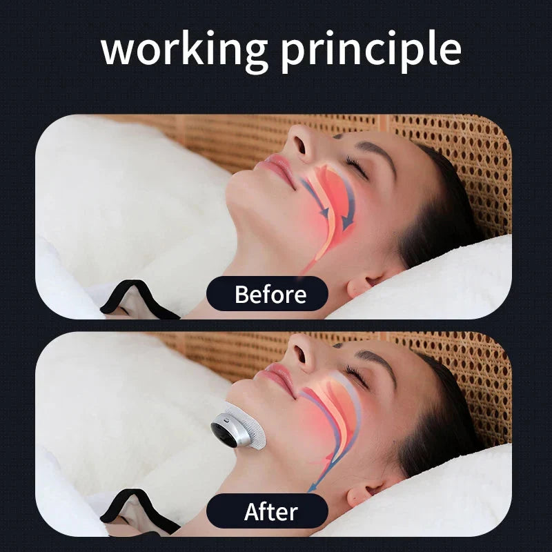 Smart Anti-Snoring Device with Muscle Stimulation