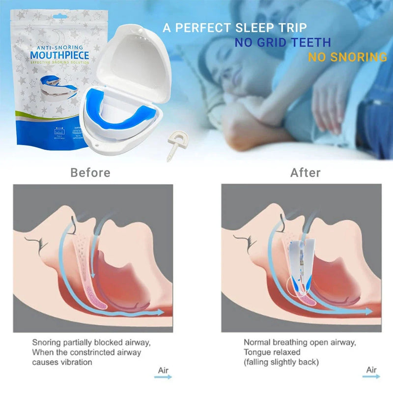 Anti-Snoring & Bruxism Mouth Guard – Sleeping Aid for Teeth Grinding
