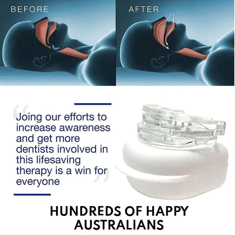 Anti-Snoring Mouthpiece Sleep Guard